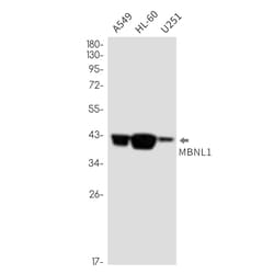 Invitrogen MBNL1 Recombinant Rabbit Monoclonal Antibody (K01_2N20) 100 &mu;L | Buy Online | Invitrogen&trade; | Fisher Scientific
