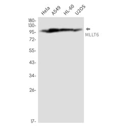 Invitrogen MLLT6 Recombinant Rabbit Monoclonal Antibody (K01_2N33) 50 &mu;L | Buy Online | Invitrogen&trade; | Fisher Scientific
