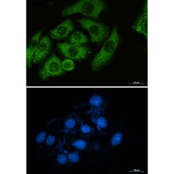 Invitrogen Moesin Recombinant Rabbit Monoclonal Antibody (K01_2N34) 50 &mu;L | Buy Online | Invitrogen&trade; | Fisher Scientific