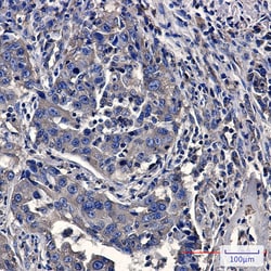 Invitrogen Moesin Recombinant Rabbit Monoclonal Antibody (K01_2N34) 50 &mu;L | Buy Online | Invitrogen&trade; | Fisher Scientific