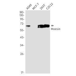 Invitrogen Moesin Recombinant Rabbit Monoclonal Antibody (K01_2N34) 50 &mu;L | Buy Online | Invitrogen&trade; | Fisher Scientific