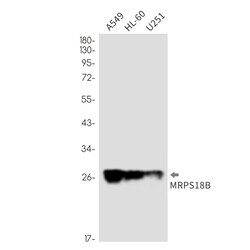 Invitrogen MRPS18B Recombinant Rabbit Monoclonal Antibody (K01_2N37) 100 &mu;L | Buy Online | Invitrogen&trade; | Fisher Scientific