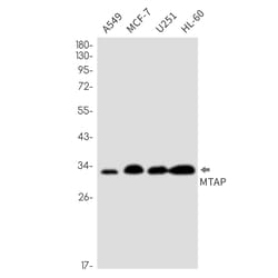 Invitrogen MTAP Recombinant Rabbit Monoclonal Antibody (K01_2N38) 50 &mu;L | Buy Online | Invitrogen&trade; | Fisher Scientific