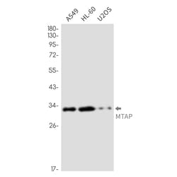 Invitrogen MTAP Recombinant Rabbit Monoclonal Antibody (K01_2N40) 50 &mu;L | Buy Online | Invitrogen&trade; | Fisher Scientific