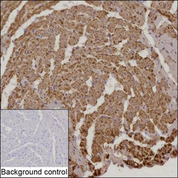 Invitrogen NDUFS2 Recombinant Rabbit Monoclonal Antibody (K01_2N47) 100 &mu;L | Buy Online | Invitrogen&trade; | Fisher Scientific