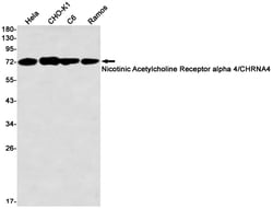 Invitrogen CHRNA4 Recombinant Rabbit Monoclonal Antibody (K01_2N54) 50 &mu;L | Buy Online | Invitrogen&trade; | Fisher Scientific