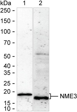 Invitrogen NME3 Recombinant Rabbit Monoclonal Antibody (K01_2N58) 100 &mu;L | Buy Online | Invitrogen&trade; | Fisher Scientific