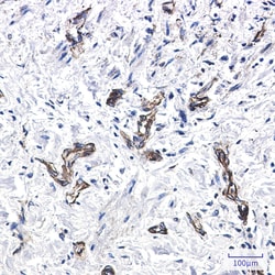 Invitrogen MYH9 Recombinant Rabbit Monoclonal Antibody (K01_2N59) 50 &mu;L | Buy Online | Invitrogen&trade; | Fisher Scientific