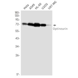 Invitrogen Optineurin Recombinant Rabbit Monoclonal Antibody (K01_2N71) 100 &mu;L | Buy Online | Invitrogen&trade; | Fisher Scientific