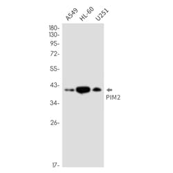 Invitrogen PIM2 Recombinant Rabbit Monoclonal Antibody (K01_2N93) 50 &mu;L | Buy Online | Invitrogen&trade; | Fisher Scientific