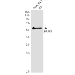 Invitrogen PRPF4 Recombinant Rabbit Monoclonal Antibody (K01_2P10) 50 &mu;L | Buy Online | Invitrogen&trade; | Fisher Scientific