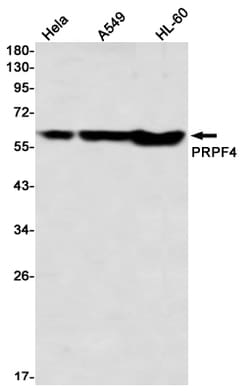 Invitrogen PRPF4 Recombinant Rabbit Monoclonal Antibody (K01_2P10) 50 &mu;L | Buy Online | Invitrogen&trade; | Fisher Scientific