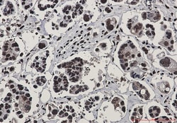 Invitrogen RAD50 Recombinant Rabbit Monoclonal Antibody (K01_2P20) 100 &mu;L | Buy Online | Invitrogen&trade; | Fisher Scientific