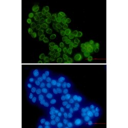Invitrogen RANGAP1 Recombinant Rabbit Monoclonal Antibody (K01_2P23) 50 &mu;L | Buy Online | Invitrogen&trade; | Fisher Scientific