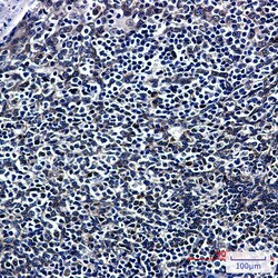 Invitrogen RANGAP1 Recombinant Rabbit Monoclonal Antibody (K01_2P23) 50 &mu;L | Buy Online | Invitrogen&trade; | Fisher Scientific