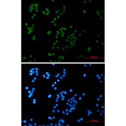 Invitrogen RAP80 Recombinant Rabbit Monoclonal Antibody (K01_2P24) 50 &mu;L | Buy Online | Invitrogen&trade; | Fisher Scientific