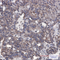 Invitrogen RAP80 Recombinant Rabbit Monoclonal Antibody (K01_2P24) 50 &mu;L | Buy Online | Invitrogen&trade; | Fisher Scientific