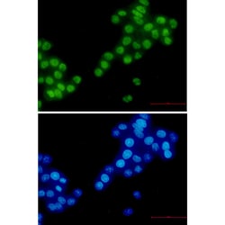 Invitrogen RBM3 Recombinant Rabbit Monoclonal Antibody (K01_2P27) 100 &mu;L | Buy Online | Invitrogen&trade; | Fisher Scientific