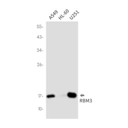 Invitrogen RBM3 Recombinant Rabbit Monoclonal Antibody (K01_2P27) 100 &mu;L | Buy Online | Invitrogen&trade; | Fisher Scientific
