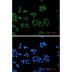 Invitrogen RhoGDI Recombinant Rabbit Monoclonal Antibody (K01_2P30) 50 &mu;L | Buy Online | Invitrogen&trade; | Fisher Scientific