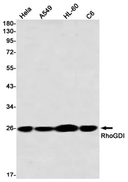 Invitrogen RhoGDI Recombinant Rabbit Monoclonal Antibody (K01_2P30) 50 &mu;L | Buy Online | Invitrogen&trade; | Fisher Scientific