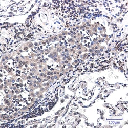 Invitrogen RSK2 Recombinant Rabbit Monoclonal Antibody (K01_2P36) 100 μL;