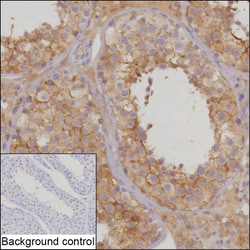 Invitrogen SEMA7A Recombinant Rabbit Monoclonal Antibody (K01_2P42) 50 &mu;L | Buy Online | Invitrogen&trade; | Fisher Scientific