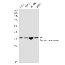 Invitrogen Serine racemase Recombinant Rabbit Monoclonal Antibody (K01_2P44) 50 &mu;L | Buy Online | Invitrogen&trade; | Fisher Scientific
