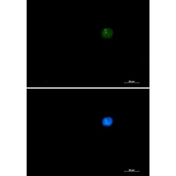 Invitrogen SMARCA2 Recombinant Rabbit Monoclonal Antibody (K01_2P50) 100 &mu;L | Buy Online | Invitrogen&trade; | Fisher Scientific