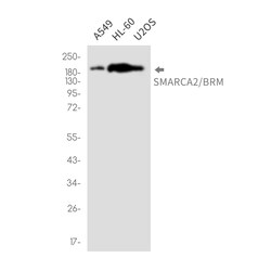 Invitrogen SMARCA2 Recombinant Rabbit Monoclonal Antibody (K01_2P50) 100 &mu;L | Buy Online | Invitrogen&trade; | Fisher Scientific