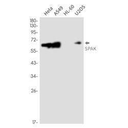 Invitrogen STK39 Recombinant Rabbit Monoclonal Antibody (K01_2P54) 100 &mu;L | Buy Online | Invitrogen&trade; | Fisher Scientific