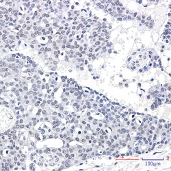 Invitrogen SPT5 Recombinant Rabbit Monoclonal Antibody (K01_2P55) 50 &mu;L | Buy Online | Invitrogen&trade; | Fisher Scientific