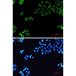 Invitrogen&trade;&nbsp;TBP Recombinant Rabbit Monoclonal Antibody (K01_2P67)