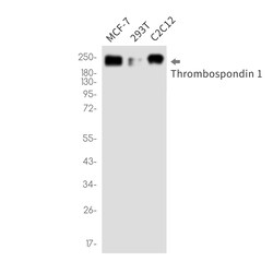 Invitrogen Thrombospondin 1 Recombinant Rabbit Monoclonal Antibody (K01_2P75) 100 &mu;L | Buy Online | Invitrogen&trade; | Fisher Scientific