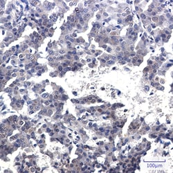 Invitrogen Torc2 Recombinant Rabbit Monoclonal Antibody (K01_2P79) 50 &mu;L | Buy Online | Invitrogen&trade; | Fisher Scientific
