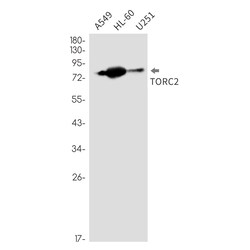 Invitrogen Torc2 Recombinant Rabbit Monoclonal Antibody (K01_2P79) 50 &mu;L | Buy Online | Invitrogen&trade; | Fisher Scientific