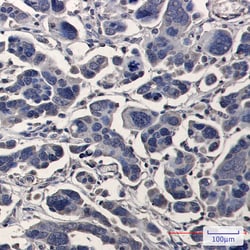 Invitrogen TPMT Recombinant Rabbit Monoclonal Antibody (K01_2P80) 50 &mu;L | Buy Online | Invitrogen&trade; | Fisher Scientific