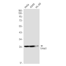 Invitrogen TPMT Recombinant Rabbit Monoclonal Antibody (K01_2P80) 50 &mu;L | Buy Online | Invitrogen&trade; | Fisher Scientific