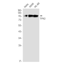 Invitrogen TPX2 Recombinant Rabbit Monoclonal Antibody (K01_2P81) 50 &mu;L | Buy Online | Invitrogen&trade; | Fisher Scientific