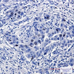 Invitrogen TPX2 Recombinant Rabbit Monoclonal Antibody (K01_2P82) 50 &mu;L | Buy Online | Invitrogen&trade; | Fisher Scientific