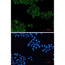 Invitrogen VAV2 Recombinant Rabbit Monoclonal Antibody (K01_2P98) 100 &mu;L | Buy Online | Invitrogen&trade; | Fisher Scientific