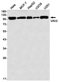 Invitrogen VAV2 Recombinant Rabbit Monoclonal Antibody (K01_2P98) 100 &mu;L | Buy Online | Invitrogen&trade; | Fisher Scientific