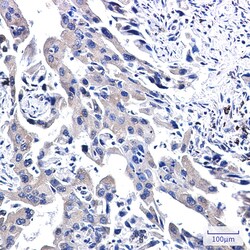 Invitrogen WWOX Recombinant Rabbit Monoclonal Antibody (K01_2Q01) 100 &mu;L | Buy Online | Invitrogen&trade; | Fisher Scientific