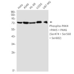 Invitrogen Phospho-PAK4/6/7 (Ser474, Ser560, Ser602) Recombinant Rabbit Monoclonal Antibody (K01_2Q24) 100 &mu;L | Buy Online | Invitrogen&trade; | Fisher Scientific