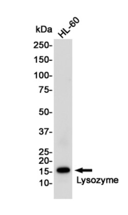 Invitrogen Lysozyme Recombinant Rabbit Monoclonal Antibody (K01_2Q34) 100 &mu;L | Buy Online | Invitrogen&trade; | Fisher Scientific