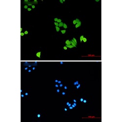 Invitrogen&trade;&nbsp;PLK1 Recombinant Rabbit Monoclonal Antibody (K01_2Q37)