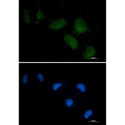 Invitrogen GC Recombinant Rabbit Monoclonal Antibody (K01_2Q40) 50 &mu;L | Buy Online | Invitrogen&trade; | Fisher Scientific