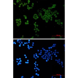 Invitrogen CRCP Recombinant Rabbit Monoclonal Antibody (K01_2Q42) 50 &mu;L | Buy Online | Invitrogen&trade; | Fisher Scientific