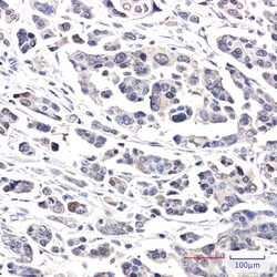 Invitrogen CRCP Recombinant Rabbit Monoclonal Antibody (K01_2Q42) 50 &mu;L | Buy Online | Invitrogen&trade; | Fisher Scientific