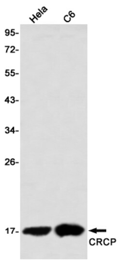 Invitrogen CRCP Recombinant Rabbit Monoclonal Antibody (K01_2Q42) 50 &mu;L | Buy Online | Invitrogen&trade; | Fisher Scientific